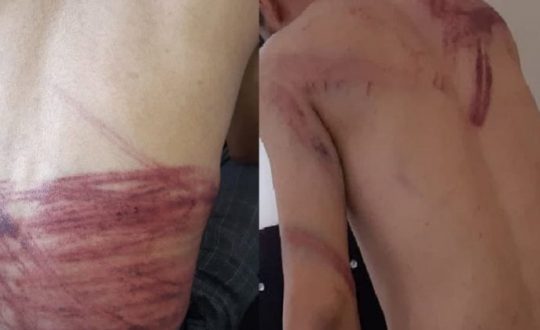jornalistas torturados por talibas 08092021 08092021123650169 Visor Notícias