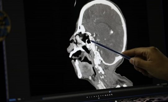 miiase oral el salud 800x533 1 Visor Notícias