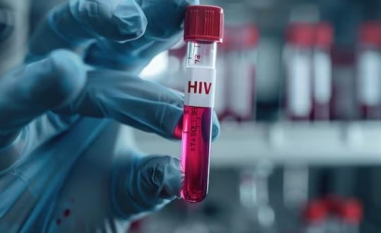 hiv Visor Notícias