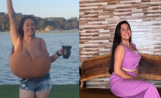 jovem seios Visor Notícias
