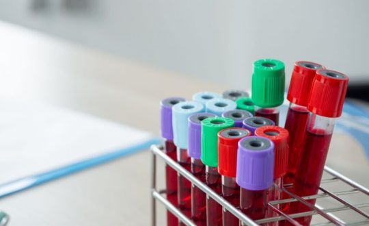 tubos de exame de sangue com tampas coloridas na grade em laboratório