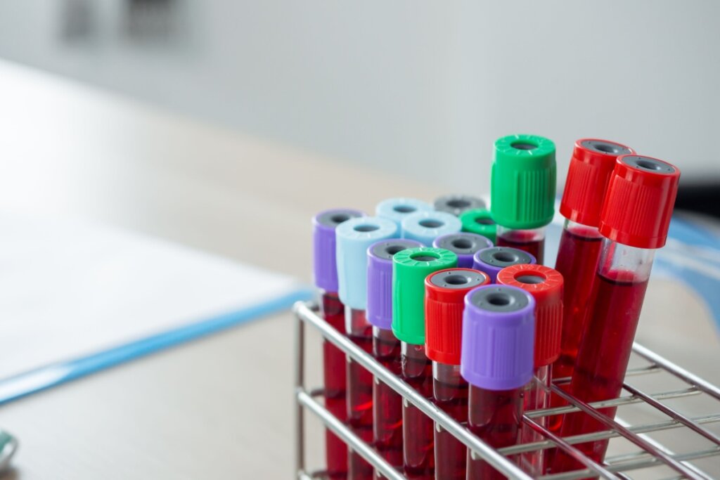 tubos de exame de sangue com tampas coloridas na grade em laboratório